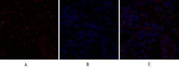 C/EBP beta antibody