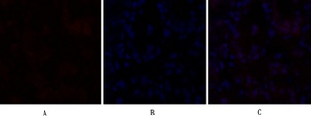 C/EBP beta antibody