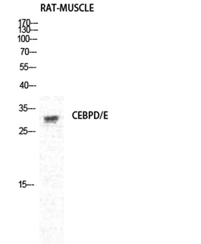 C/EBP δ/ε rabbit pAb