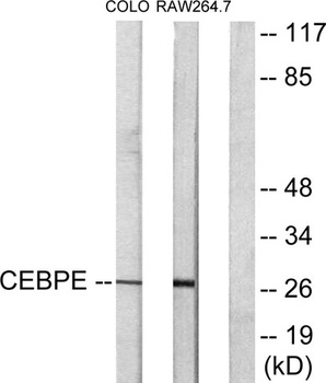 C/EBP δ/ε rabbit pAb