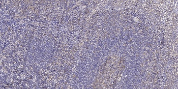 C/EBP δ/ε rabbit pAb