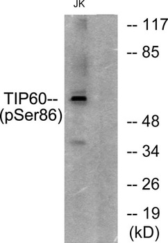 TIP60 (phospho Ser86) rabbit pAb