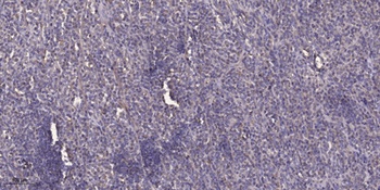 TIP60 (phospho-Ser86) antibody