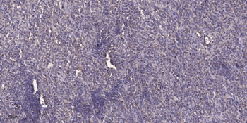 TIP60 (phospho Ser86) rabbit pAb