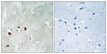 TIP60 (phospho Ser90) rabbit pAb