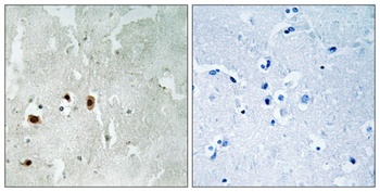 TIP60 (phospho-Ser90) antibody