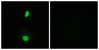 TIP60 rabbit pAb Antibody