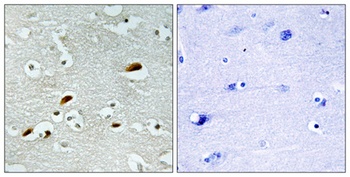 TIP60 rabbit pAb Antibody