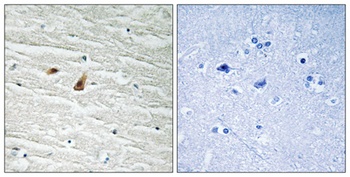 C/EBP ε (phospho Thr74) rabbit pAb