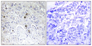 B-ATF antibody