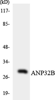 PHAPI2 antibody