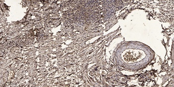 SLU7 rabbit pAb