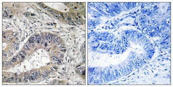 IRE1 alpha/beta antibody