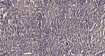 PDLIM5 (phospho Tyr251) rabbit pAb