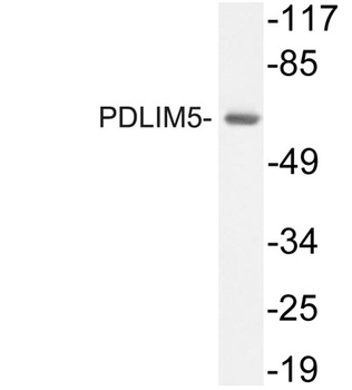 PDLIM5 rabbit pAb