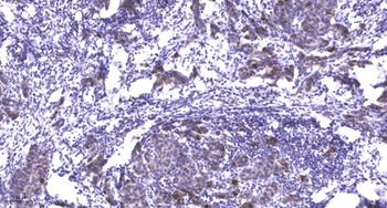 PDLIM5 rabbit pAb
