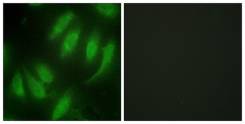 Hexim1 antibody