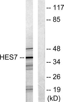 Hexim1 rabbit pAb