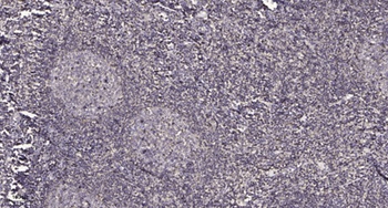 POLR3C antibody