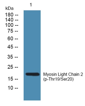 MLC-2 (phospho-Thr17/S18) antibody