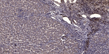 MLC-2 (phospho Thr17/S18) rabbit pAb