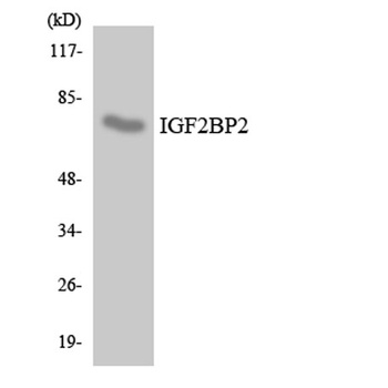 IGF2-BP2 rabbit pAb