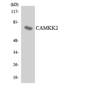 CaMKK2 antibody