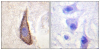 DNAM-1 (phospho Ser329) rabbit pAb
