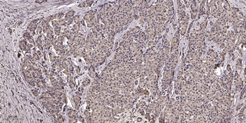 NFAT5 (phospho Ser155) rabbit pAb