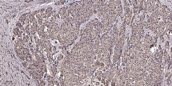 NFAT5 (phospho-Ser155) antibody