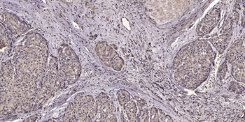 NFAT5 (phospho-Ser1197) antibody