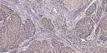 NFAT5 (phospho Ser1197) rabbit pAb