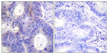 p23 (phospho-Ser113) antibody