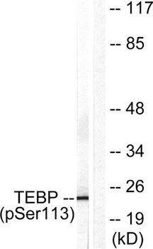 p23 (phospho-Ser113) antibody