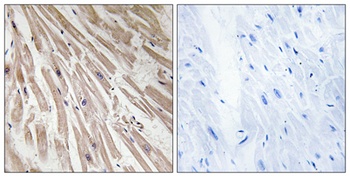 ARPP-21 antibody