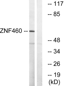 ZNF460 rabbit pAb