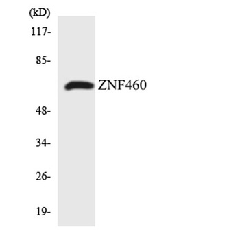 ZNF460 rabbit pAb