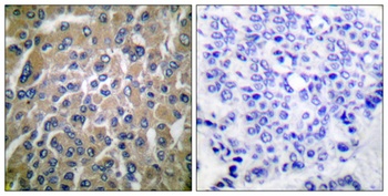 Choriogonadotropin β rabbit pAb