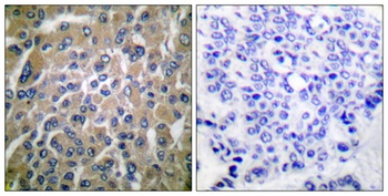 Choriogonadotropin beta antibody