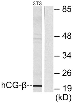 Choriogonadotropin beta antibody