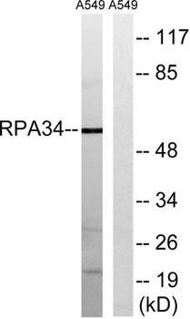 CD3EAP antibody