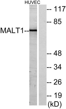 MALT1 rabbit pAb