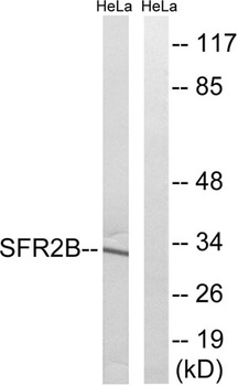 SRp46 rabbit pAb