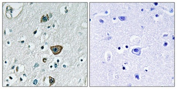 Rab 40B antibody