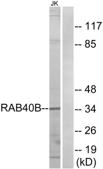 Rab 40B antibody