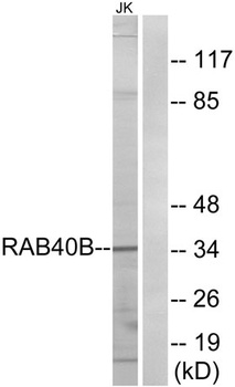 Rab 40B rabbit pAb