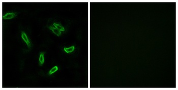 ACSVL6 rabbit pAb