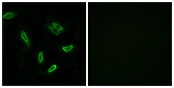 ACSVL6 antibody