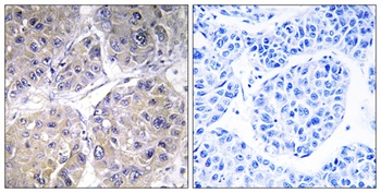 ACSVL6 rabbit pAb