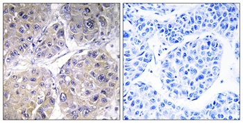 ACSVL6 antibody